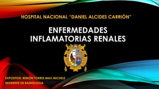 HOSPITAL NACIONAL “DANIEL ALCIDES CARRIÓN” 
ENFERMEDADES 
INFLAMATORIAS RENALES 
EXPOSITOR: REMÓN TORRES MAX MICHELE 
RESIDENTE DE RADIOLOGIA 
 