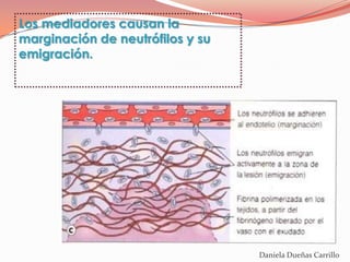 Los mediadores causan la
marginación de neutrófilos y su
emigración.




                                  Daniela Dueñas Carrillo
 