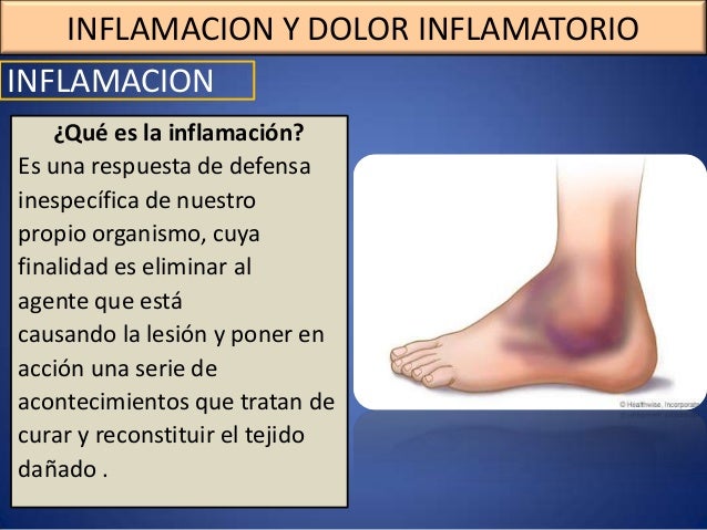 Mejores ideas dolor fuerte de espalda