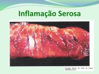 Inflamação Serosa
Exsudato Seroso em cólon de Equino
(WERNER, 2010).
 