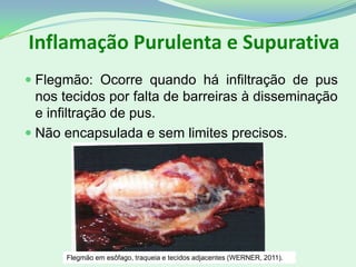 Inflamação Purulenta e Supurativa
 Flegmão: Ocorre quando há infiltração de pus
nos tecidos por falta de barreiras à disseminação
e infiltração de pus.
 Não encapsulada e sem limites precisos.
Flegmão em esôfago, traqueia e tecidos adjacentes (WERNER, 2011).
 