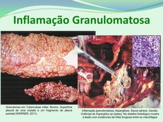 Inflamação Granulomatosa
Granulomas em Tuberculose miliar. Bovino. Superfície
pleural de uma costela e um fragmento de pleura
parietal (WERNER, 2011).
Inflamação granulomatosa. Aspergilose. Sacos aéreos. Gavião.
Colônias de Aspergillus sp (setas). No detalhe histológico mostra
a lesão com evidencias de hifas fúngicas entre os macrófagos
 