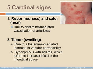 Inflamation-Pathology lecture notes | PPTX