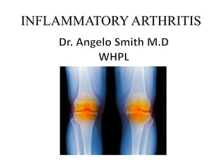 INFLAMMATORY ARTHRITIS
 