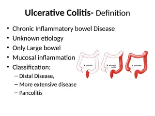 Define Colitis Inflamatory bowel disease.1332446677pptx | PPTX