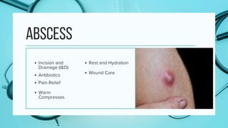 inflamatory diseases final of the skin... | PDF