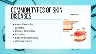 inflamatory diseases final of the skin... | PDF