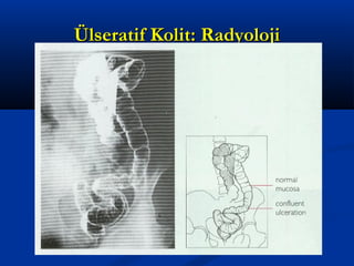ÜÜllsseerraattiiff KKoolliitt:: RRaaddyyoolloojjii 
 