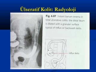 ÜÜllsseerraattiiff KKoolliitt:: RRaaddyyoolloojjii 
 