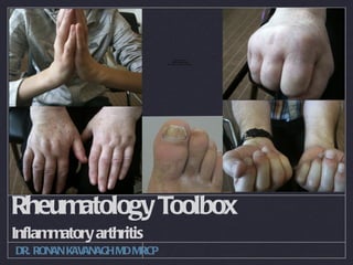 QuickTimeª and a
                                   H.264 decompressor
                             are needed to see this picture.




Rheumatology Toolbox
Inflammatory arthritis
DR. RONAN KAVANAGH MD MRCP
 