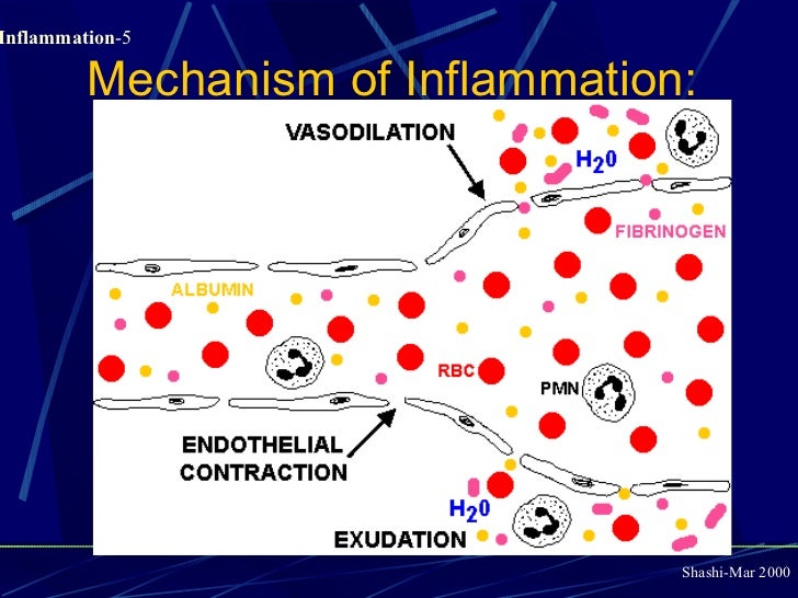 Inflammation