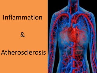 Inflammation
&
Atherosclerosis
 