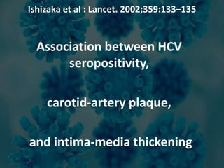 Ishizaka et al : Lancet. 2002;359:133–135
Association between HCV
seropositivity,
carotid-artery plaque,
and intima-media thickening
 