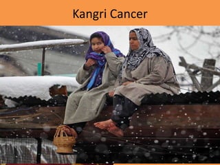 Kangri Cancer
 