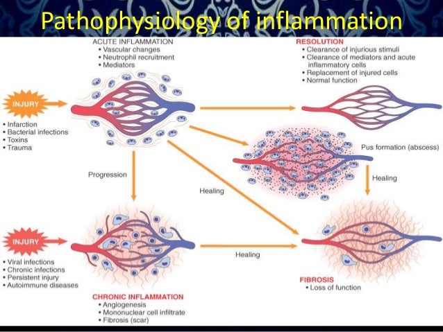 Inflammation by Dr. Amit T. Suryawanshi, Oral Surgeon, Pune