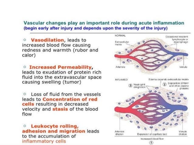 Inflammation