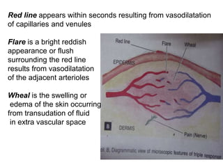 Red line appears within seconds resulting from vasodilatation
of capillaries and venules
Flare is a bright reddish
appearance or flush
surrounding the red line
results from vasodilatation
of the adjacent arterioles
Wheal is the swelling or
edema of the skin occurring
from transudation of fluid
in extra vascular space
 