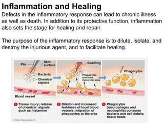 Inflammation and Healing
Defects in the inflammatory response can lead to chronic illness
as well as death. In addition to its protective function, inflammation
also sets the stage for healing and repair.
The purpose of the inflammatory response is to dilute, isolate, and
destroy the injurious agent, and to facilitate healing.
 