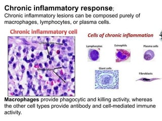 Chronic inflammatory response;
Chronic inflammatory lesions can be composed purely of
macrophages, lymphocytes, or plasma cells.
Macrophages provide phagocytic and killing activity, whereas
the other cell types provide antibody and cell-mediated immune
activity.
 