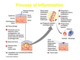 Inflamm inflammation-180121165658.pdf
