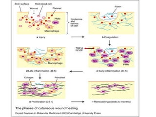 Inflammation and Healing (wound healing) | PPTX