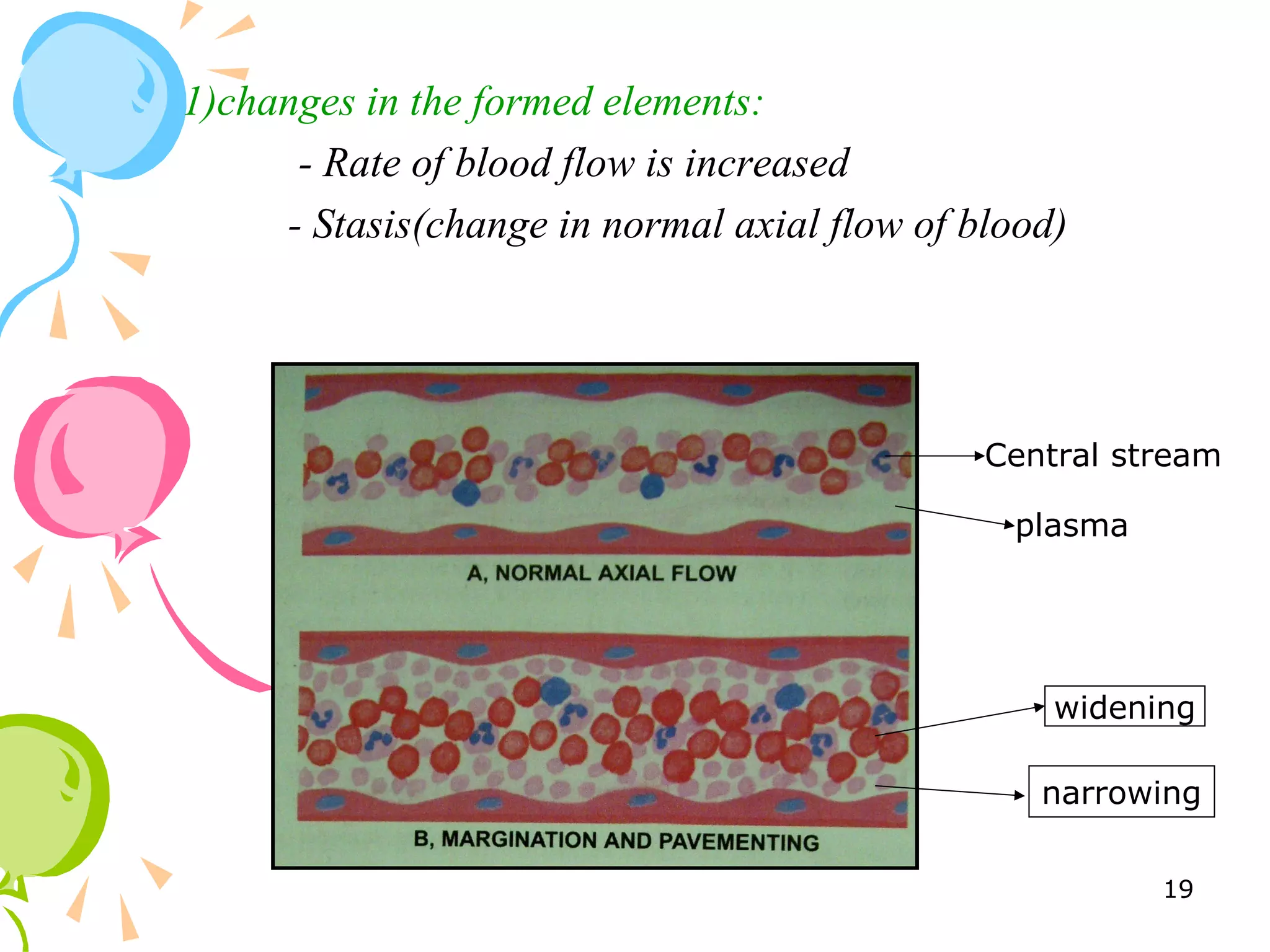 1)changes in the formed elements:
- Rate of blood flow is increased
- Stasis(change in normal axial flow of blood)
widening
narrowing
Central stream
plasma
19
 
