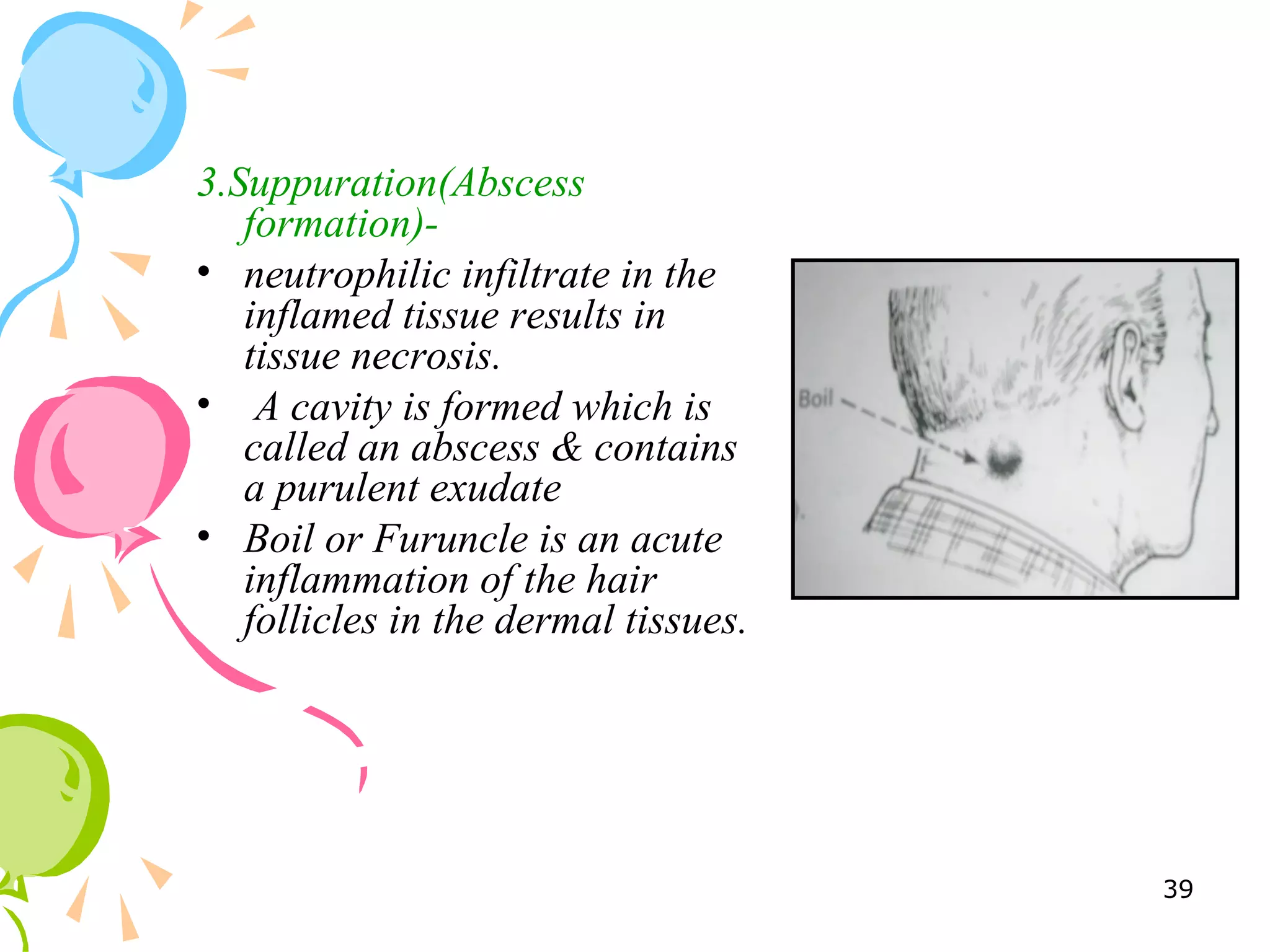 3.Suppuration(Abscess
formation)-
• neutrophilic infiltrate in the
inflamed tissue results in
tissue necrosis.
• A cavity is formed which is
called an abscess & contains
a purulent exudate
• Boil or Furuncle is an acute
inflammation of the hair
follicles in the dermal tissues.
39
 