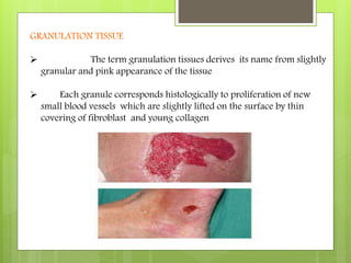 Inflammation and wound healing | PPTX