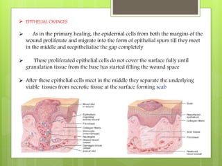 Inflammation and wound healing | PPTX