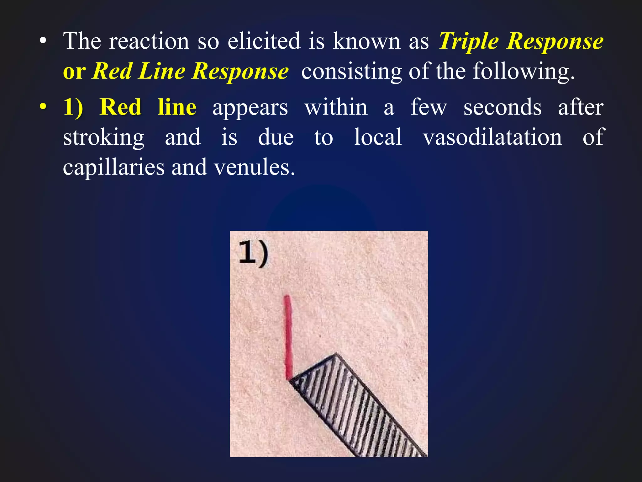 • The reaction so elicited is known as Triple Response
or Red Line Response consisting of the following.
• 1) Red line appears within a few seconds after
stroking and is due to local vasodilatation of
capillaries and venules.
 