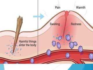 inflammation-, types signs and physiotherapy management... | PPTX