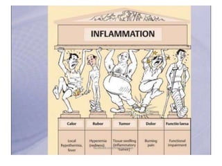Inflammation
