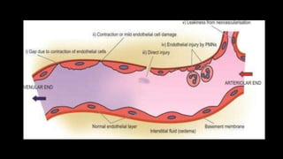 Inflammation Reflection Inflammation | PPTX