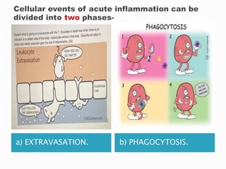 a) EXTRAVASATION. b) PHAGOCYTOSIS.
 