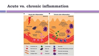 InflammatioN DEFINITION AND PHILOSOPHICAL ROOT | PPTX