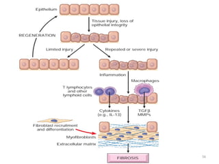 Comprehensive Overview of Inflammation: Acute and Chronic Processes ...