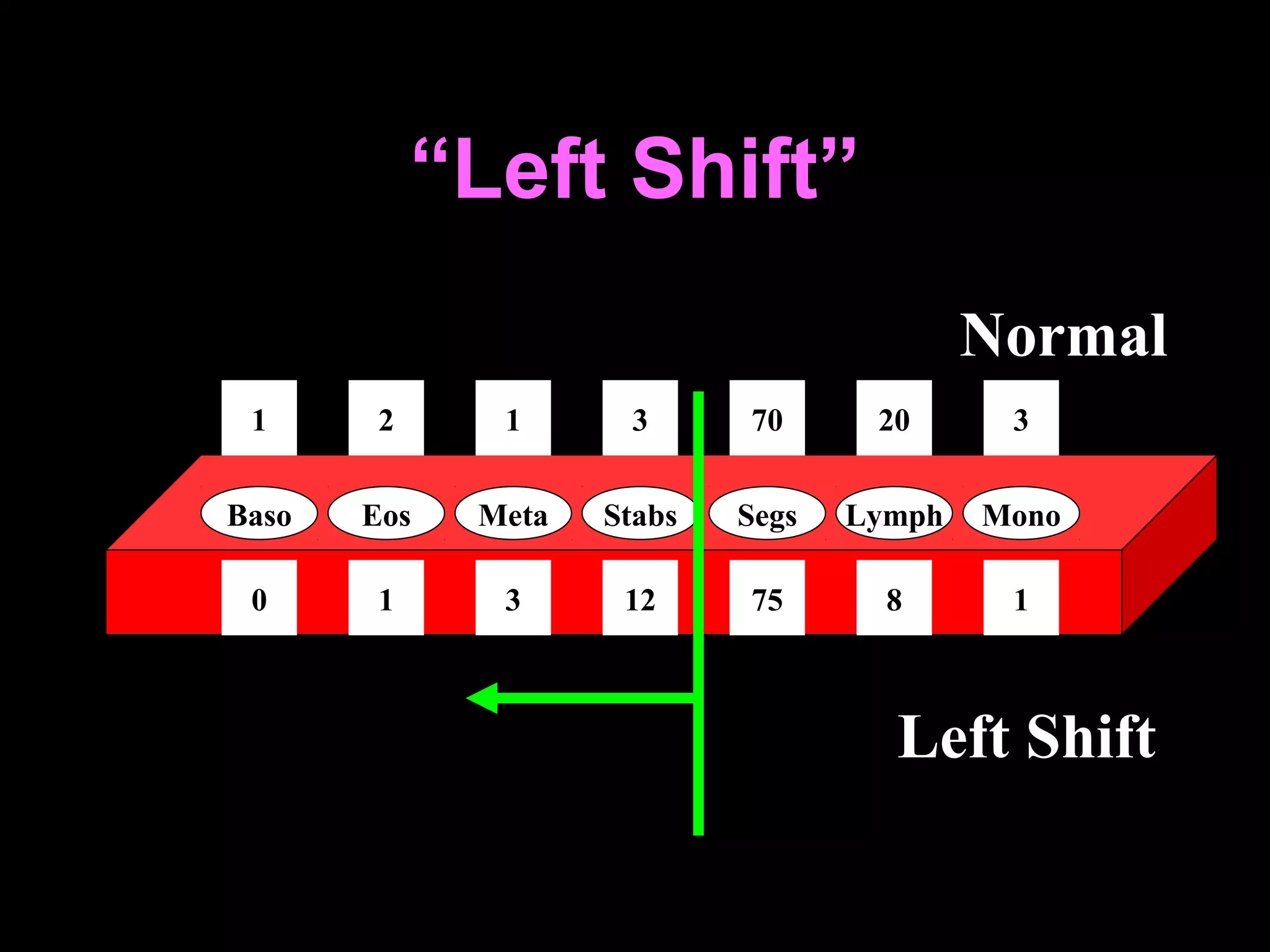 “Left Shift”
                                             Normal
 1      2     1        3       70     20      3


Baso   Eos   Meta    Stabs    Segs   Lymph   Mono

 0      1     3       12       75      8      1



                                       Left Shift

               v3-CSBRP-May-2012
 