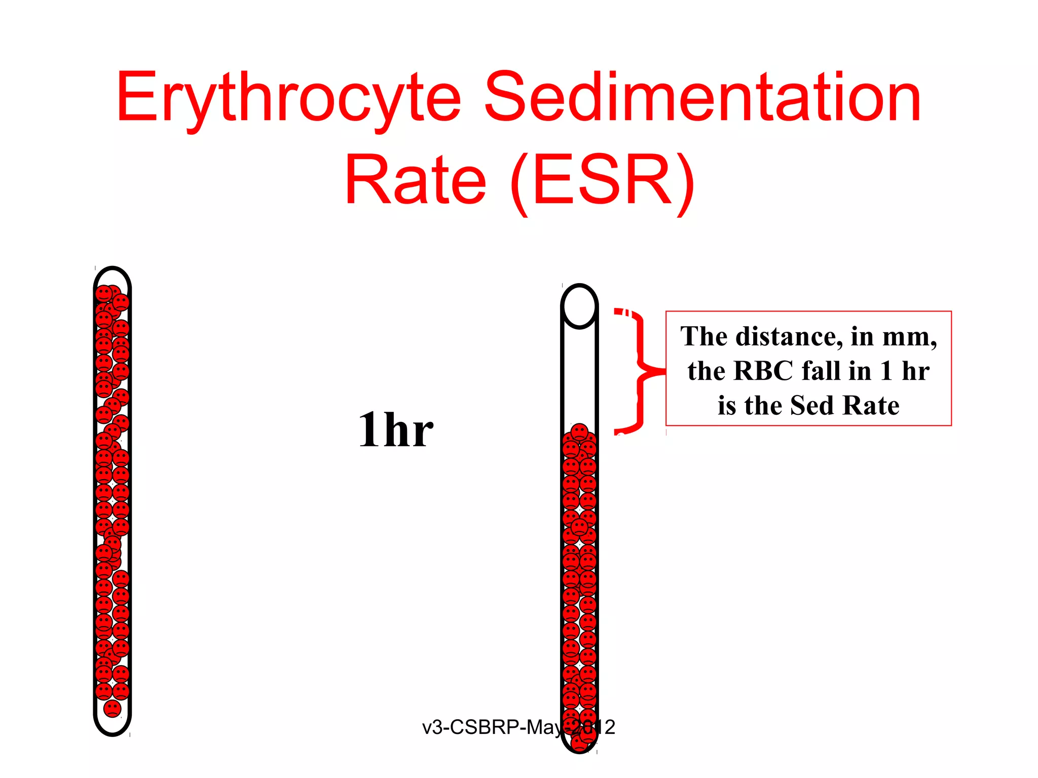 Erythrocyte Sedimentation
       Rate (ESR)
  0                            0
 10                                 The distance, in mm,
                              10
                                    the RBC fall in 1 hr
 20                           20      is the Sed Rate
 30         1hr               30
 40                           40
 50    mm                     50    mm
 60                           60
 70                           70
 80                           80
 90                           90
 100          v3-CSBRP-May-2012
                              100
 