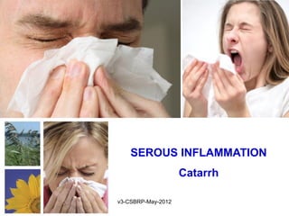 SEROUS INFLAMMATION
                    Catarrh

v3-CSBRP-May-2012
 