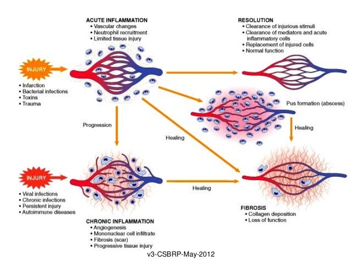 Inflammation 6