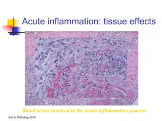 Inflammation-and-repair-lecture.ppt