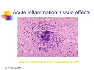 Inflammation -and-repair-lecture.ppt