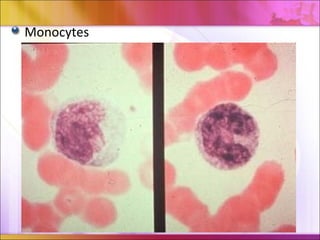 Inflammation ospe rapid review | PPT