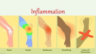 Inflammation
Dr. Abuobieda
 