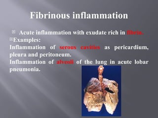 Comprehensive Overview of Acute and Chronic Inflammation Types and ...