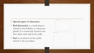 • Special types of abscesses:
• Boil (furuncle): is a small abscess
related to hair follicles or sebaceous
glands. It is commonly found in the
face, back, neck and in the axilla.
• Stye: is an abscess in the eyelid
related to the eye lashes.
 