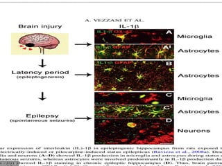 Inflammation and epilepsy | PDF