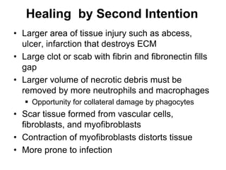 Healing by Second Intention
• Larger area of tissue injury such as abcess,
ulcer, infarction that destroys ECM
• Large clot or scab with fibrin and fibronectin fills
gap
• Larger volume of necrotic debris must be
removed by more neutrophils and macrophages
 Opportunity for collateral damage by phagocytes
• Scar tissue formed from vascular cells,
fibroblasts, and myofibroblasts
• Contraction of myofibroblasts distorts tissue
• More prone to infection
 
