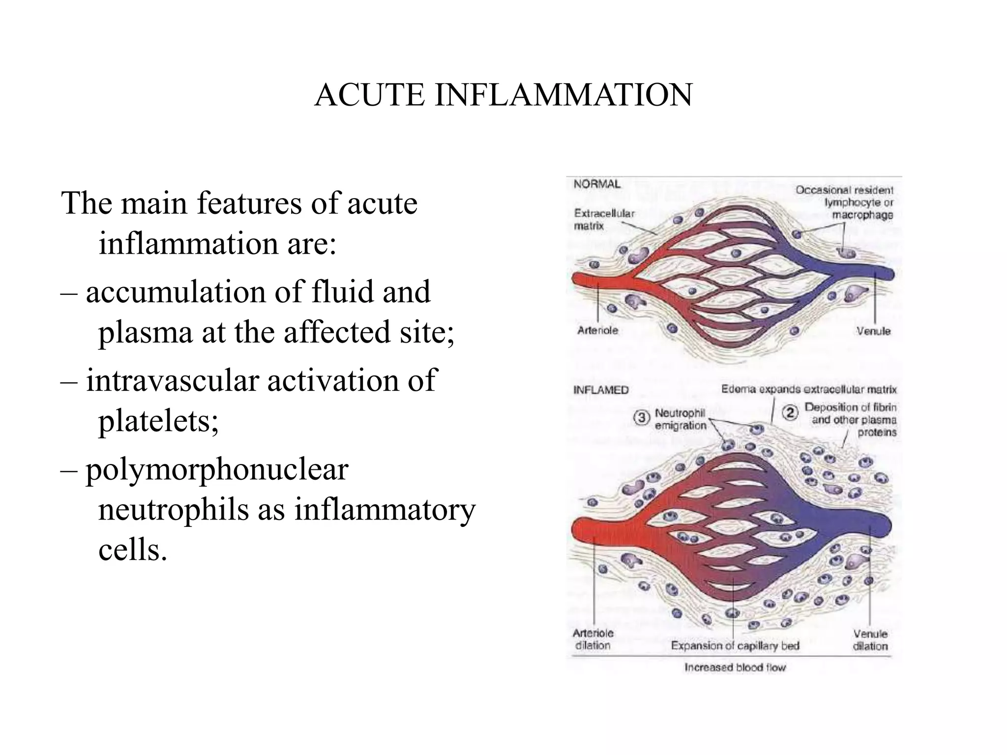 ACUTE INFLAMMATION
The main features of acute
inflammation are:
– accumulation of fluid and
plasma at the affected site;
– intravascular activation of
platelets;
– polymorphonuclear
neutrophils as inflammatory
cells.
 