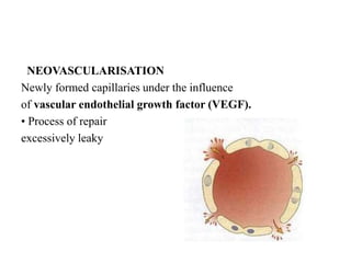 NEOVASCULARISATION
Newly formed capillaries under the influence
of vascular endothelial growth factor (VEGF).
• Process of repair
excessively leaky
 